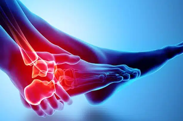 A medical illustration of a human foot by Artik Med shows the bones highlighted in blue, with the ankle joint area appearing red, indicating pain or injury. The background is a gradient of blue. This artwork exemplifies the best quality medical supply available in Florida.