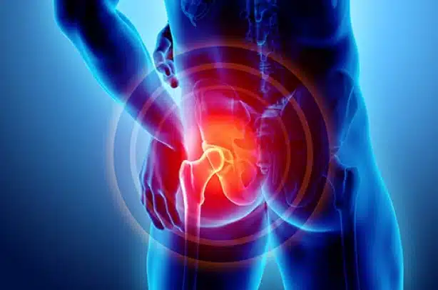 A medical 3D illustration features a person holding their lower back and hip area, with a red glow indicating pain or inflammation in the hip joint, created by Artik Med, known for providing the Best Quality Medical Supply in Florida.