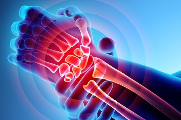 3D illustration of a hand and wrist showing bones and joints with highlighted red areas indicating pain or inflammation, brought to you by Artik Med in Florida.