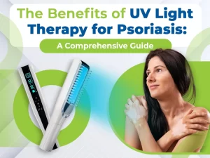 The Benefits of UV Light Therapy for Psoriasis: A Comprehensive Guide